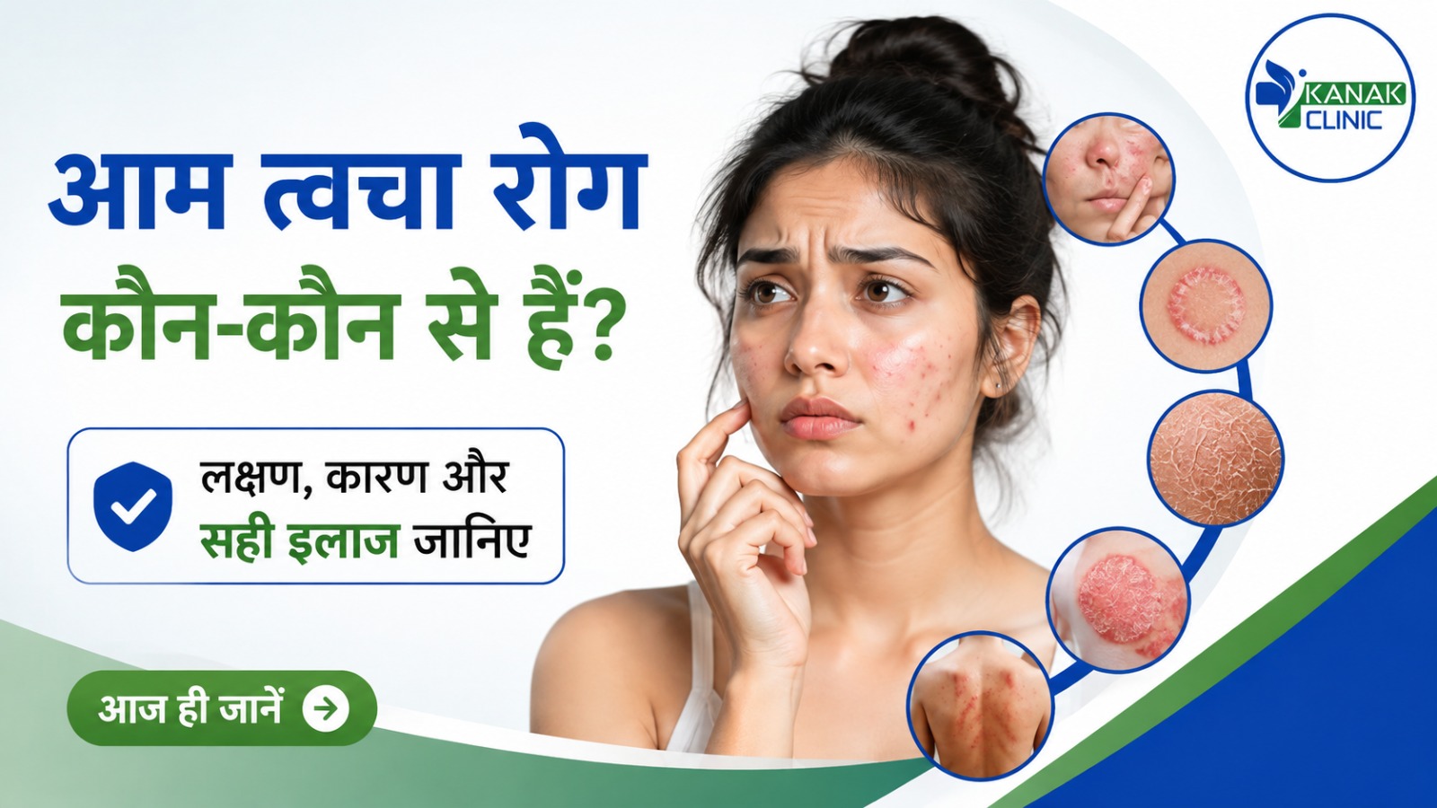 आम/सामान्य त्वचा रोग कौन-कौन से हैं? जानिए इनके लक्षण, कारण और सही इलाज